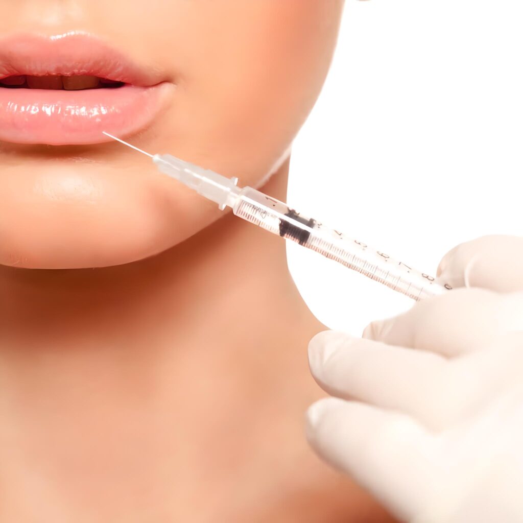 Lip-fillers-in-Pasadena Injectable Fillers Glendale CA