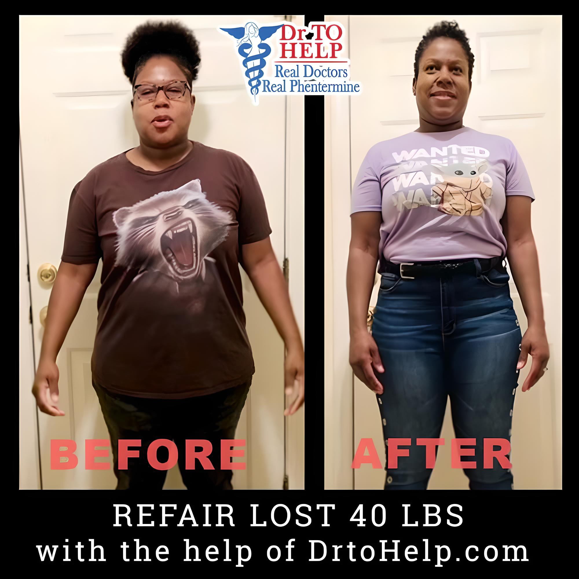 Before & After Image of Phentermine Pasadena CA